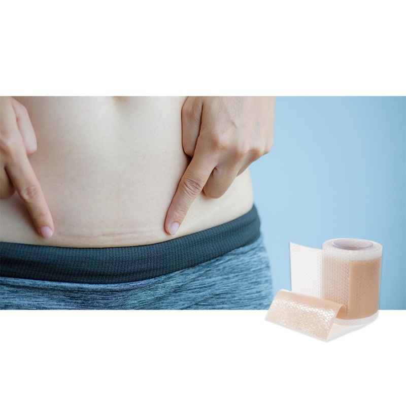Scar Roll Supplier - Silicone Self-adhesive Waterproof