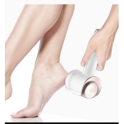 Electric Pedicure File Supplier - Portable USB Rechargeable Liquid Vacuum Callus Remover