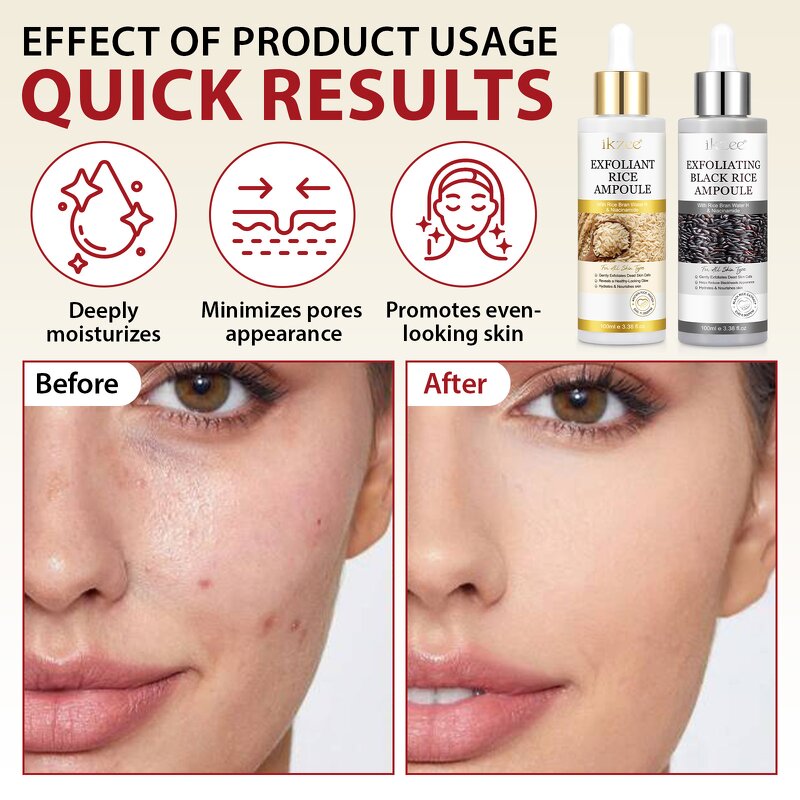 Korean Skin Care Serum Manufacturer - 100ml Peel Shot Glow Moisturizing Hydrating Exfoliating Ampoule for All Skin Types