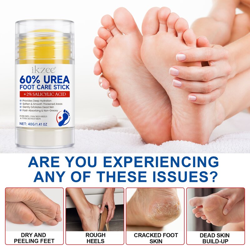Urea Cream Stick Manufacturer - 60% Urea for Exfoliating Dry Cracked Skin on Feet Hands Knees