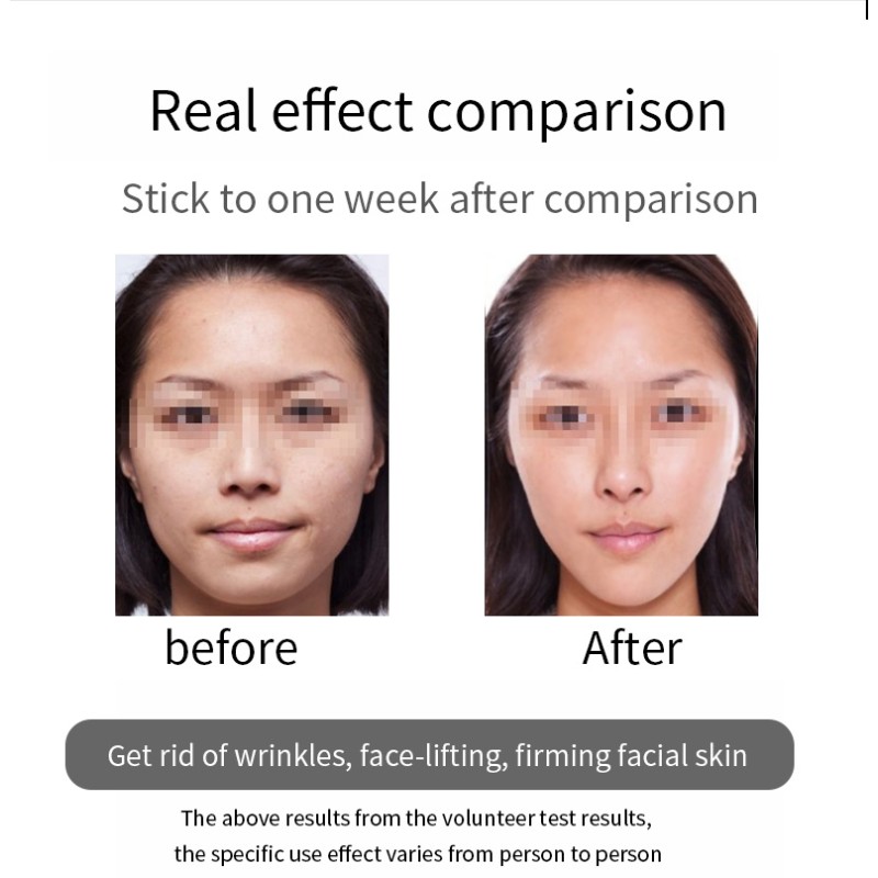 Anti-Wrinkle Machine Manufacturer - USB Home Use Firming Massager