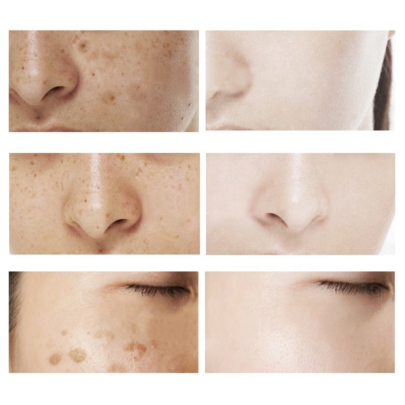 Organic Gift Set Factory - KOUNISH Turmeric Skincare Whitening