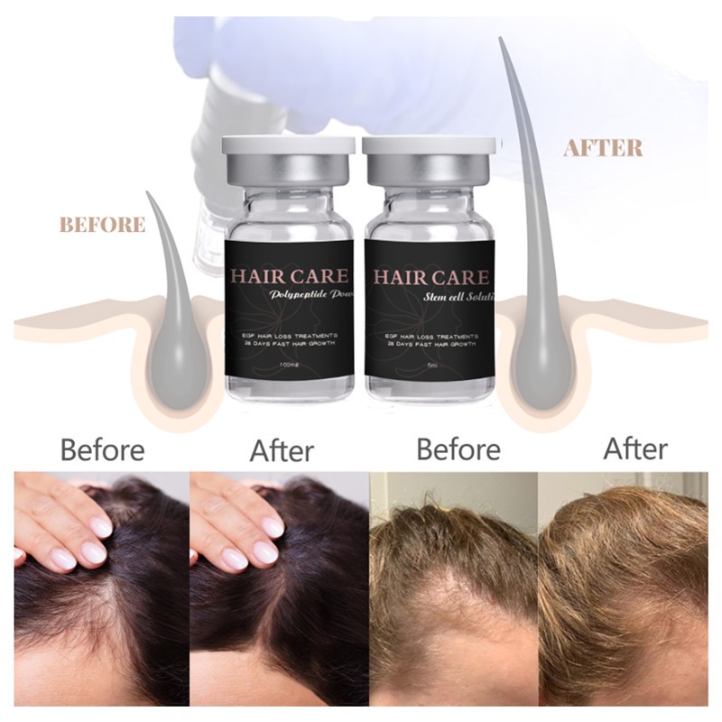 Hair Loss Solution Supplier - ZS EGF Anti-Aging Follicle Repair