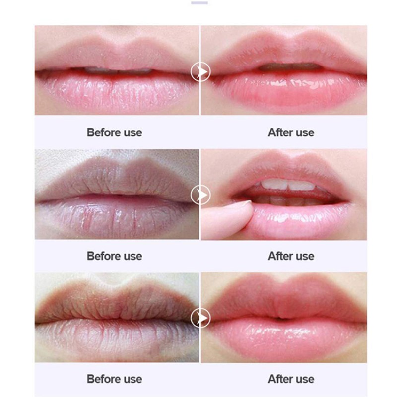 Lip Care Set Supplier - Wholesale Natural Organic Exfoliation