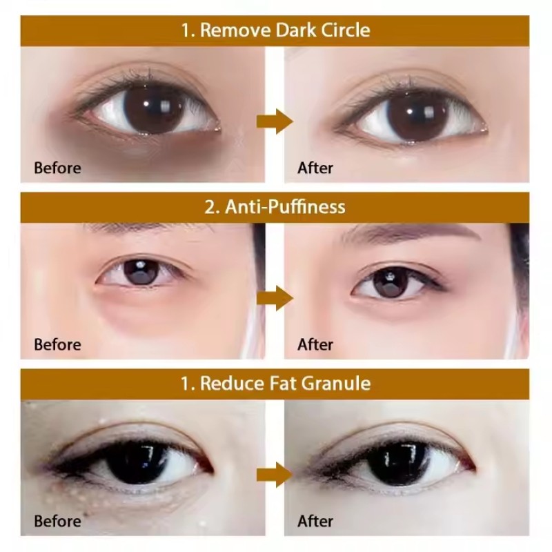 Anti-Wrinkle Eye Patches Factory - Custom Organic 24K Gel