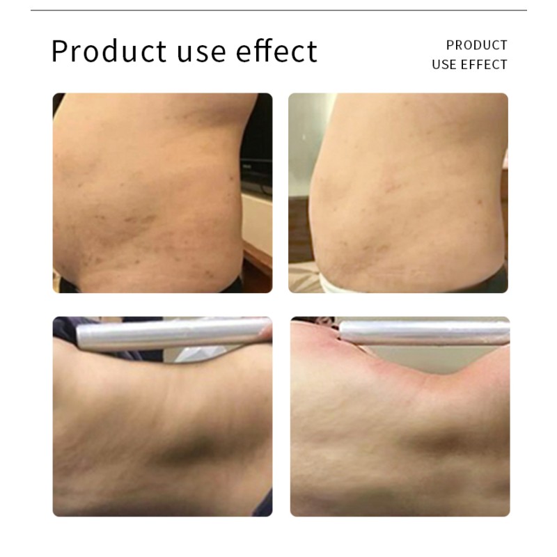 RF Beauty Machine Supplier - High Frequency Skin Lifting Salon