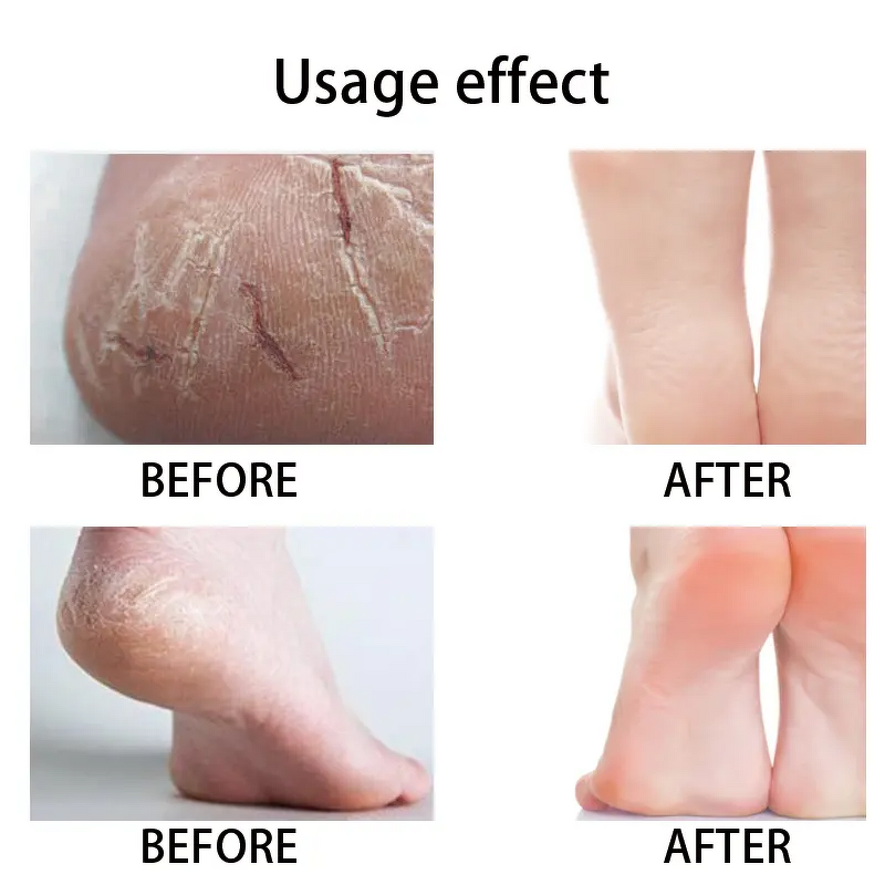 Milk Wood Fruit Foot Scrub Manufacturer - Moisturizing Mud for Dead Skin & Keratin Removal