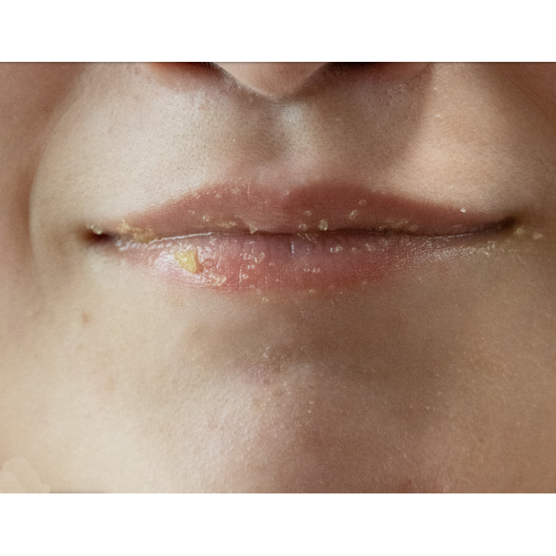 Vegan Lip Scrub Set Manufacturer - Organic Exfoliating & Moisturizing in 5 Flavors