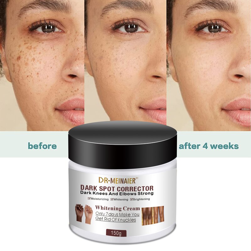 Whitening Cream Manufacturer - Dark Spot Corrector for Face & Body