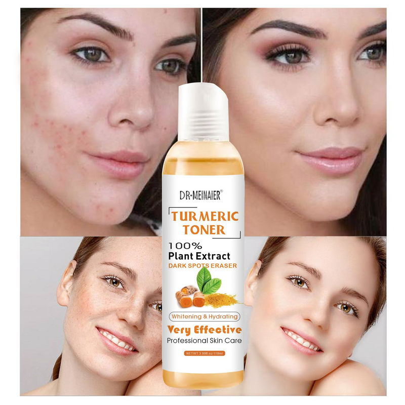 Turmeric Face Toner Manufacturer - Moisture, Whitening & Anti-Acne Skin Corrector