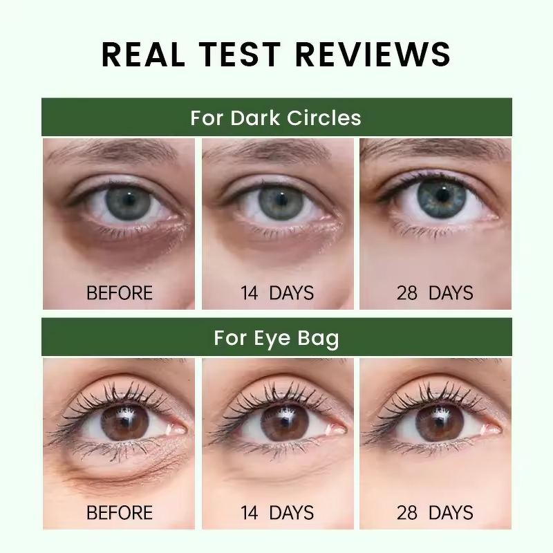 Proxylane Eye Cream Manufacturer - Anti-Bag Dark Circle Remover & Anti-Wrinkle Firming