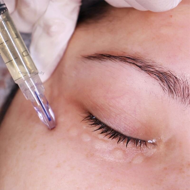 Dermal Filler Needles Manufacturer - 5 Pin Multi-Needle for Hyaluronic Acid Injection