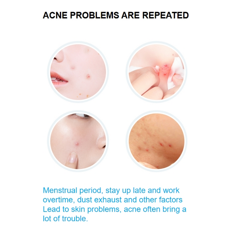 Pimple Patch Manufacturer - Private Label Hydrocolloid Customized Colorful Stars