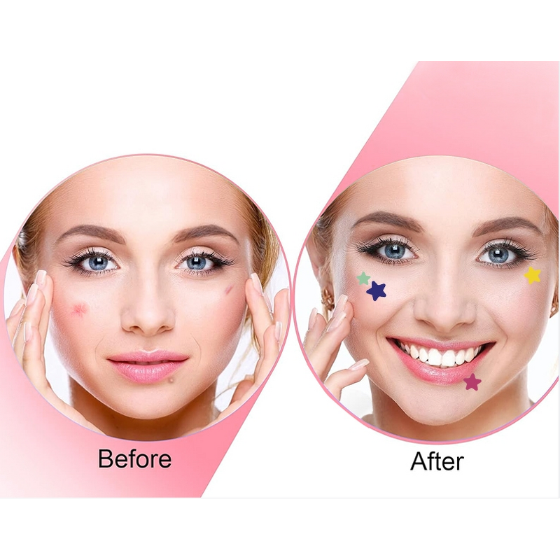 Pimple Patch Manufacturer - Private Label Hydrocolloid Customized Colorful Stars