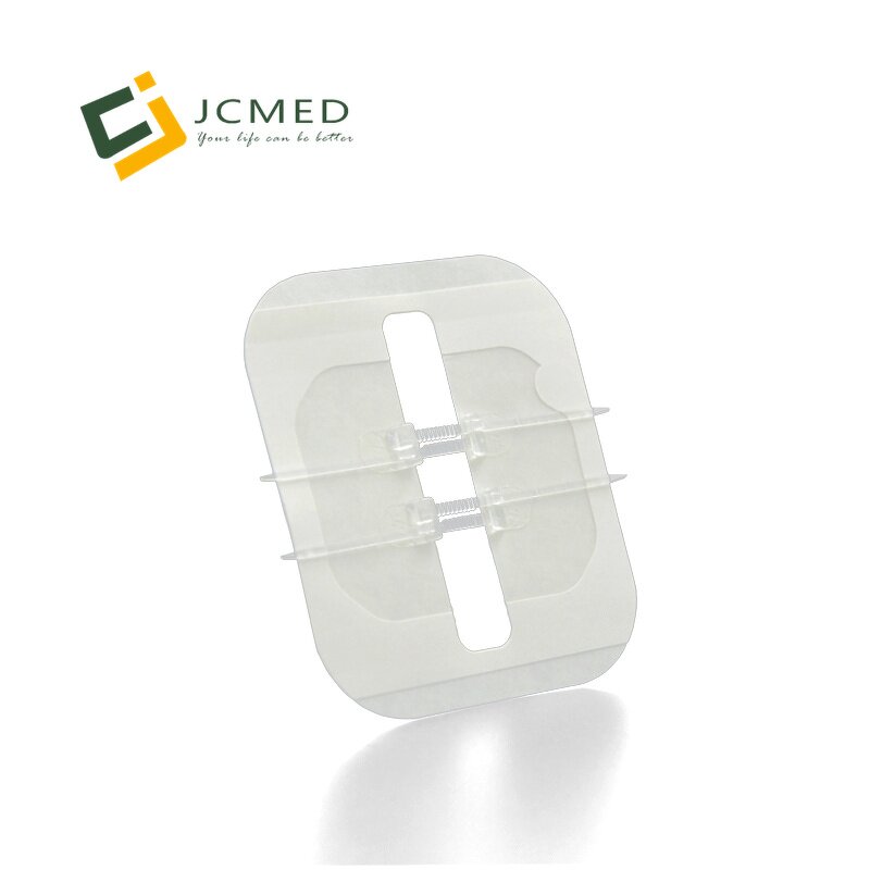 Medical Skin Wound Closure Device Manufacturer - Non-invasive Zipper Stitches Adhesive PTF1010