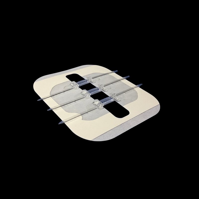 PE Wound Suture Manufacturer - Transparent Zipper Skin Zipstitch