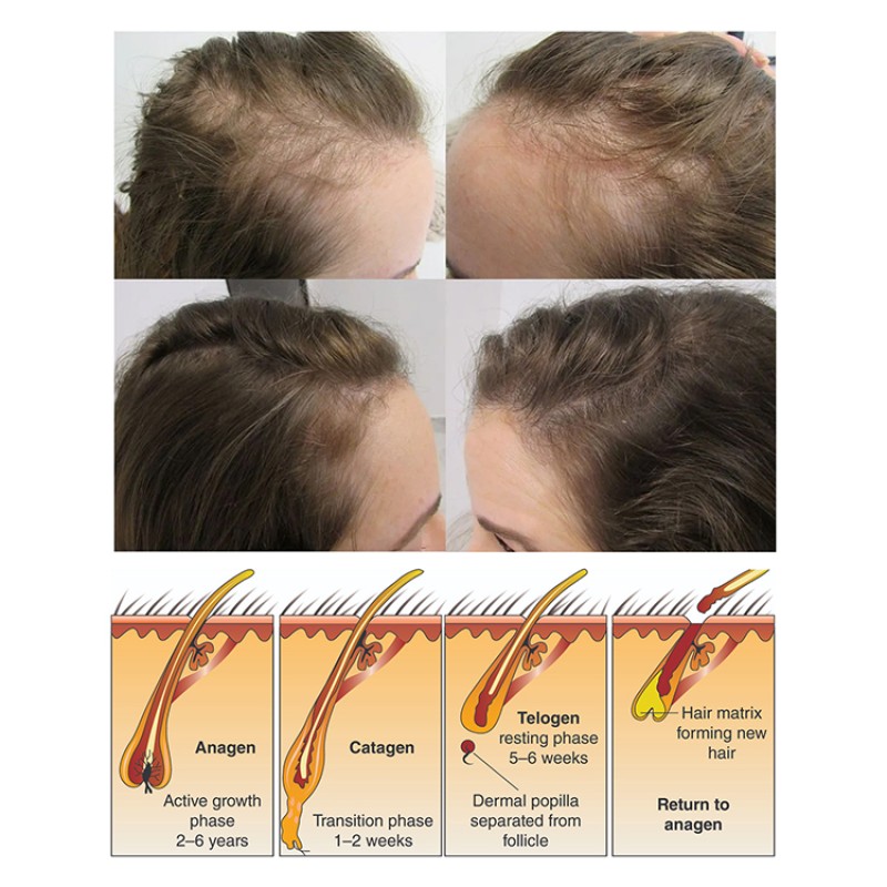 Hair Growth Serum Manufacturer - Private Label Ginger Hair Oil