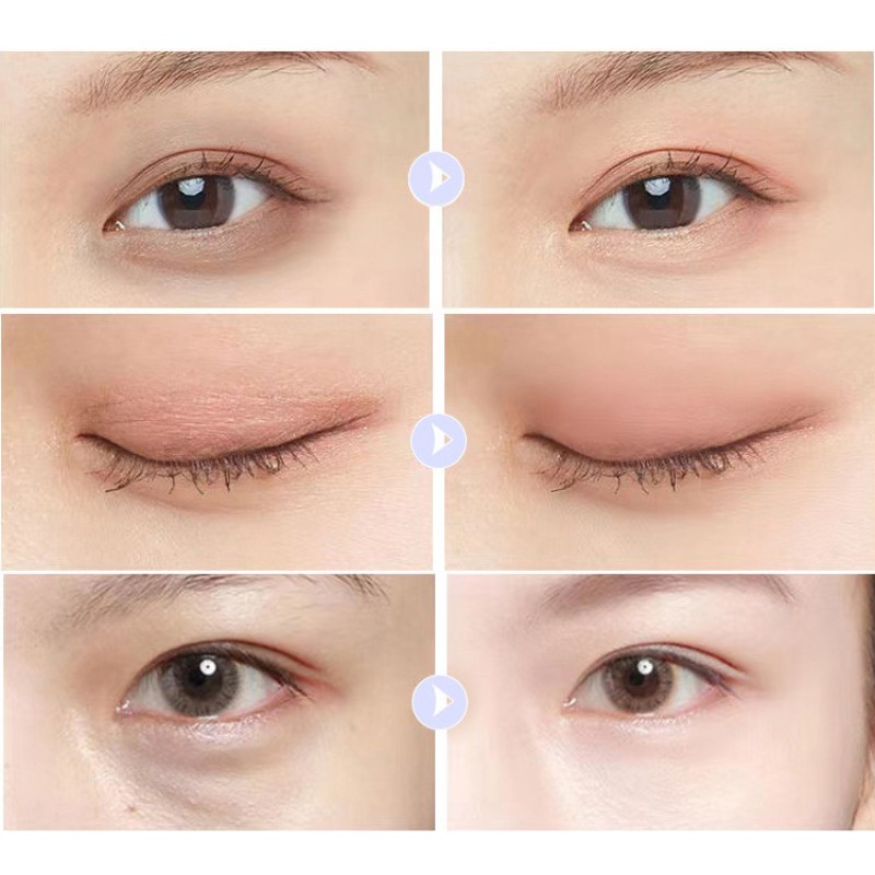 Eye Cream Factory - OEM Natural Brightening Eye Cream