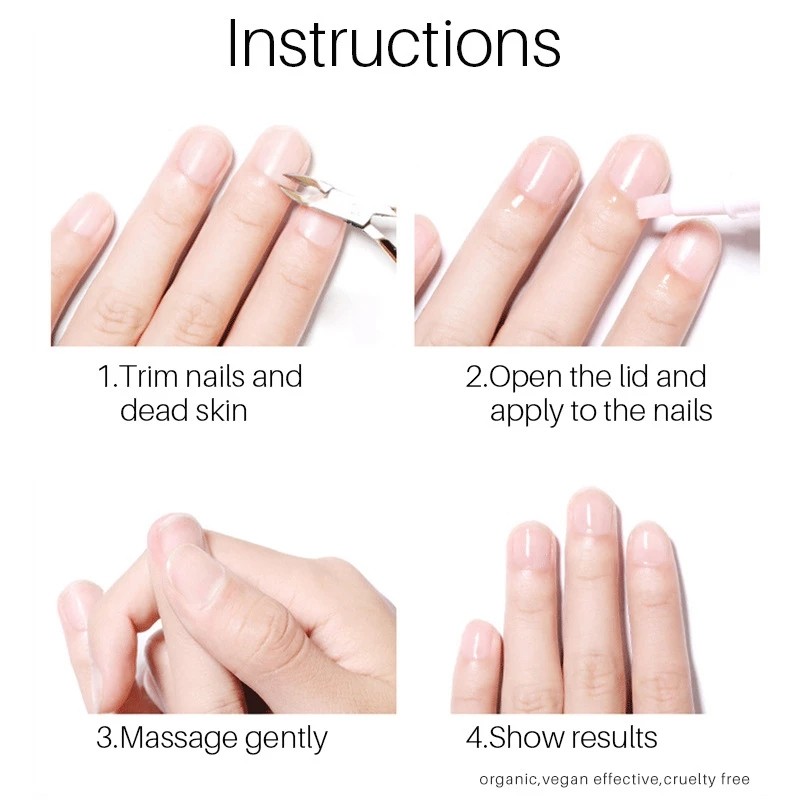 Nail Treatment Pen Factory - OEM Anti Fungal Nail Care Pen