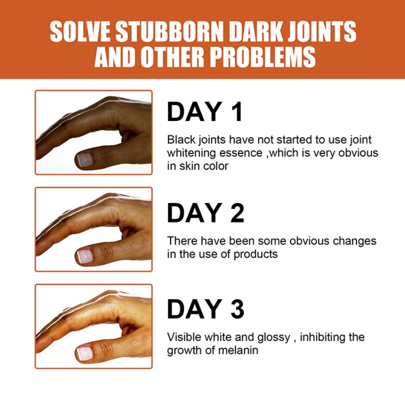 Whitening Serum Manufacturer - OEM Dark Knuckles Serum