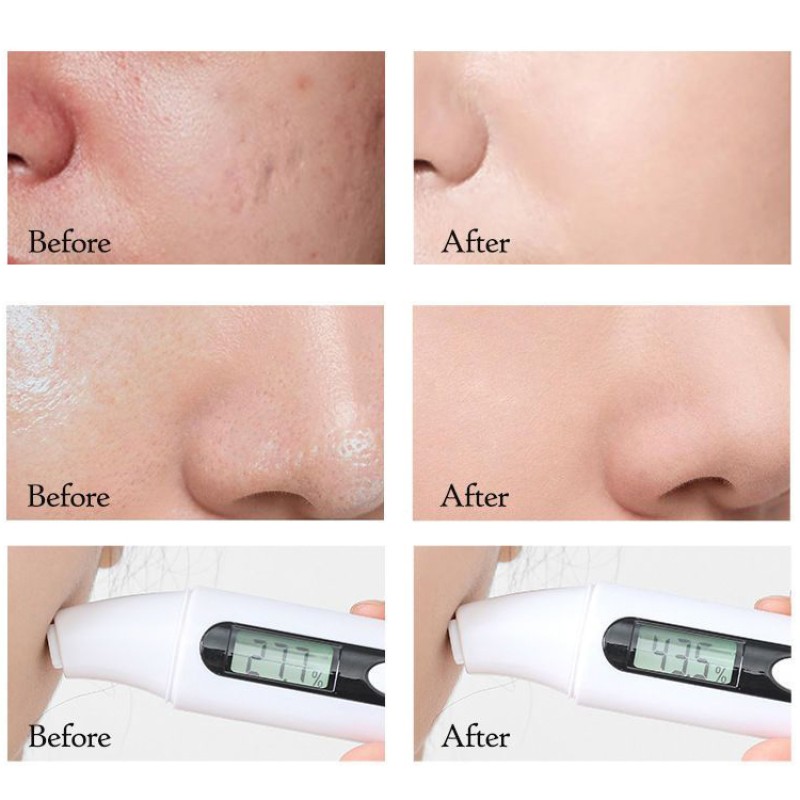 Skin Care Set Manufacturer - Custom Collagen Facial Kit