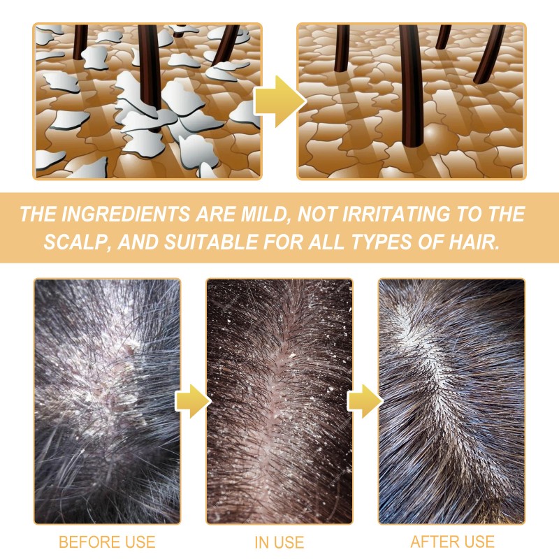 Shampoo Supplier - Private Label Rice Water Shampoo