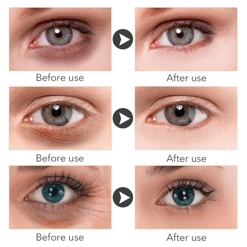 Eye Cream Supplier - Custom Under Eye Bags Removal Cream