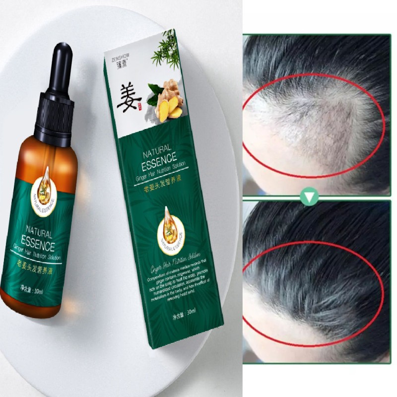 Hair Care Shampoo Manufacturer - Organic Ginger Hair Growth