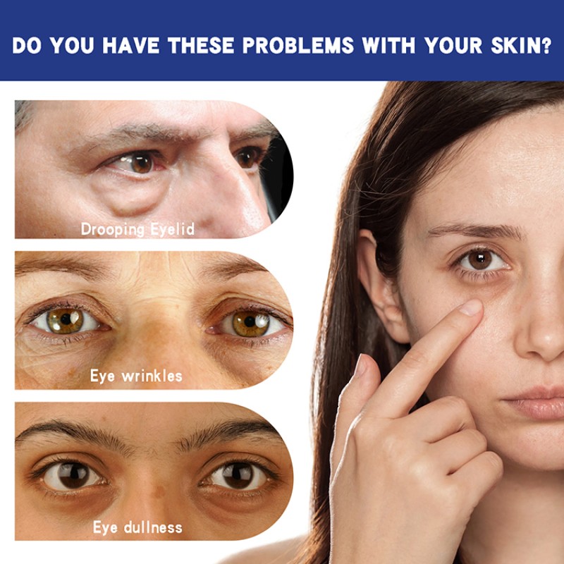 Eye Cream Supplier - ODM Tea Tree Eye Repair Cream