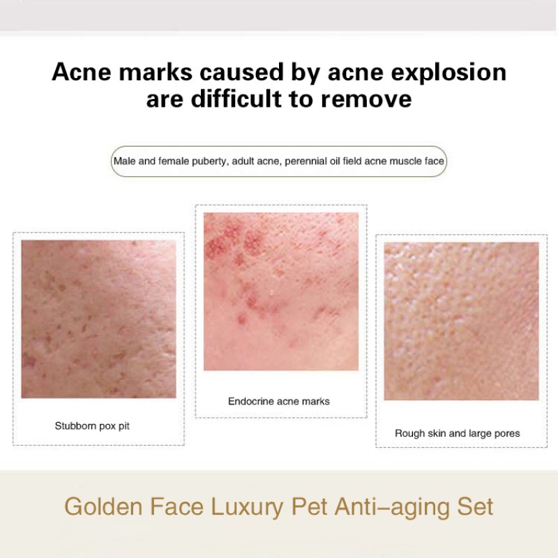 Skin Care Set Supplier - Private Label Hyaluronic Acid Set