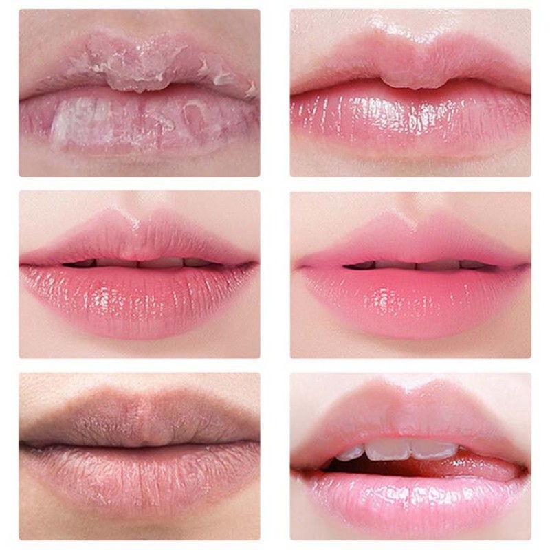 Lip Care Kit Supplier - Wholesale Exfoliating Lip Mask Set