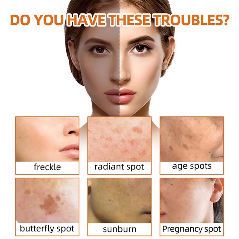 Whitening Soap Supplier - Custom Turmeric Facial Soap