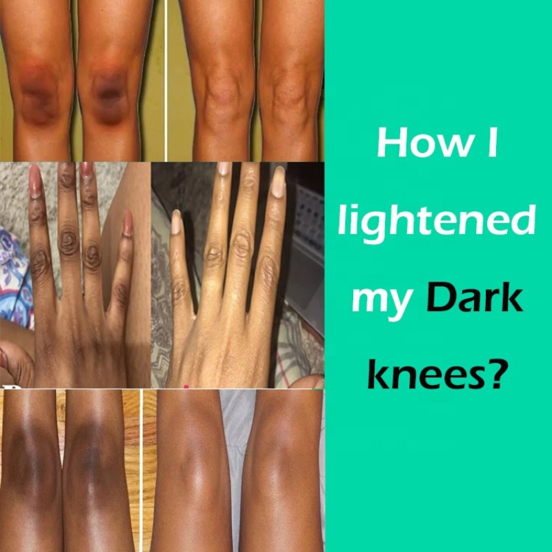 Whitening Serum Manufacturer - OEM Dark Knuckles Serum