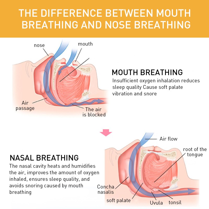 Mouth Tape Strips Supplier - Comfortable Breathing Anti Snoring