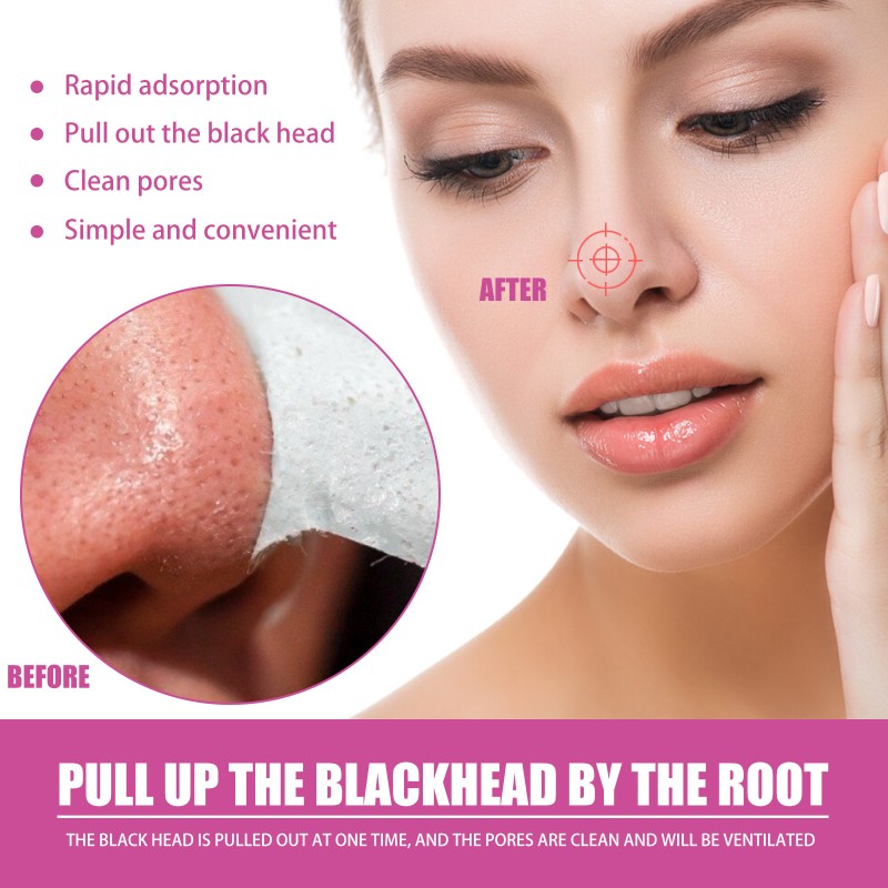 Blackhead Remover Supplier - Pores Cleaning Aloe Vera Treatment
