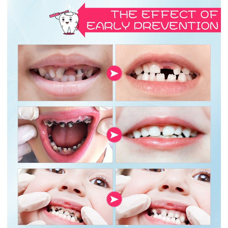 Toothpaste Foam Supplier - Fruit Flavors Kids Oral 60ml