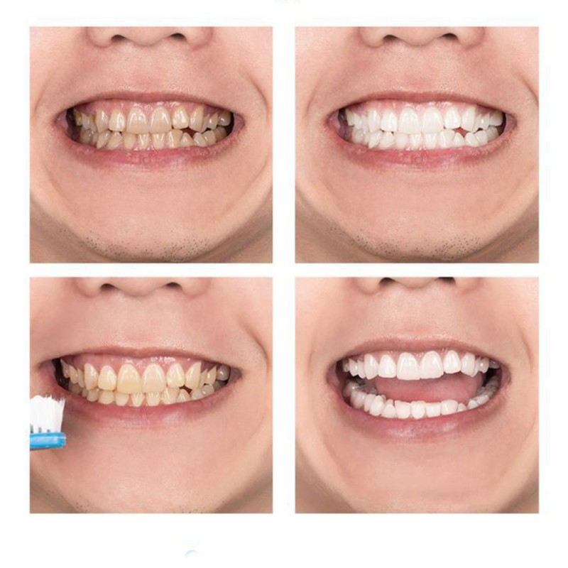 Teeth Whitening Mousse Supplier - Salon 50ml Tooth White