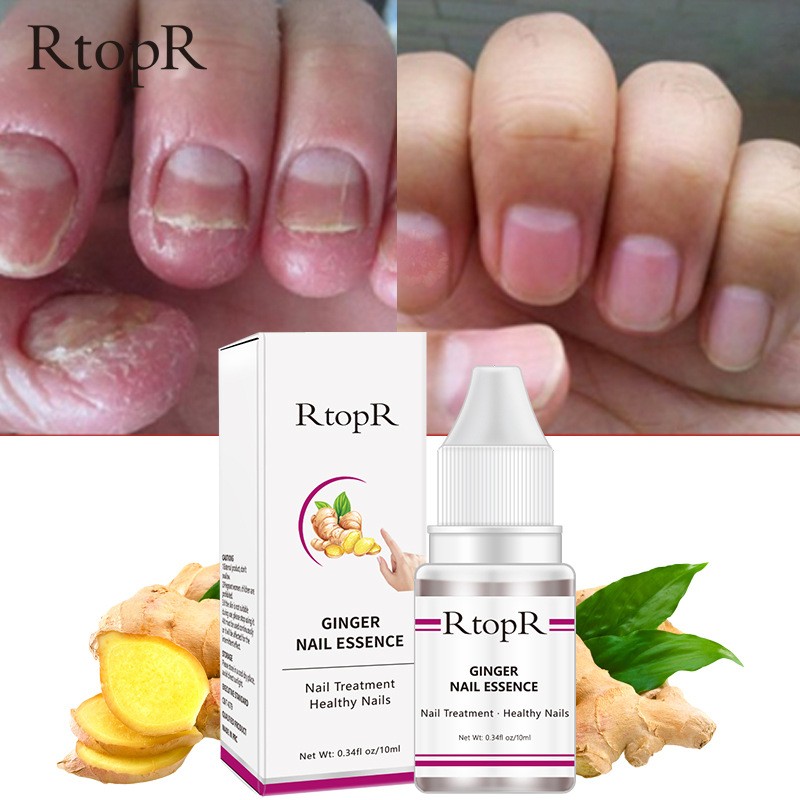 Nail Repair Serum Supplier - Herbal Fungal Treatment 10ml