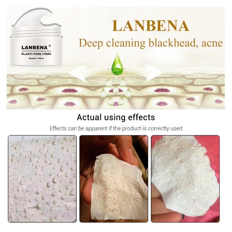 Nose Pore Strips Supplier - Blackheads Whiteheads Removal