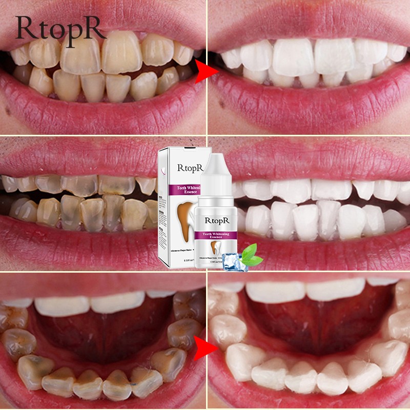 Teeth Whitening Liquid Manufacturer - Remove Plaque Stains Cleaning