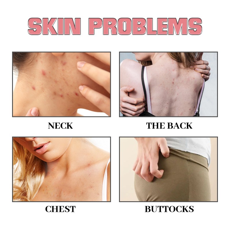 Exfoliating Soap Manufacturer - Deep Cleansing Brightening Body Care