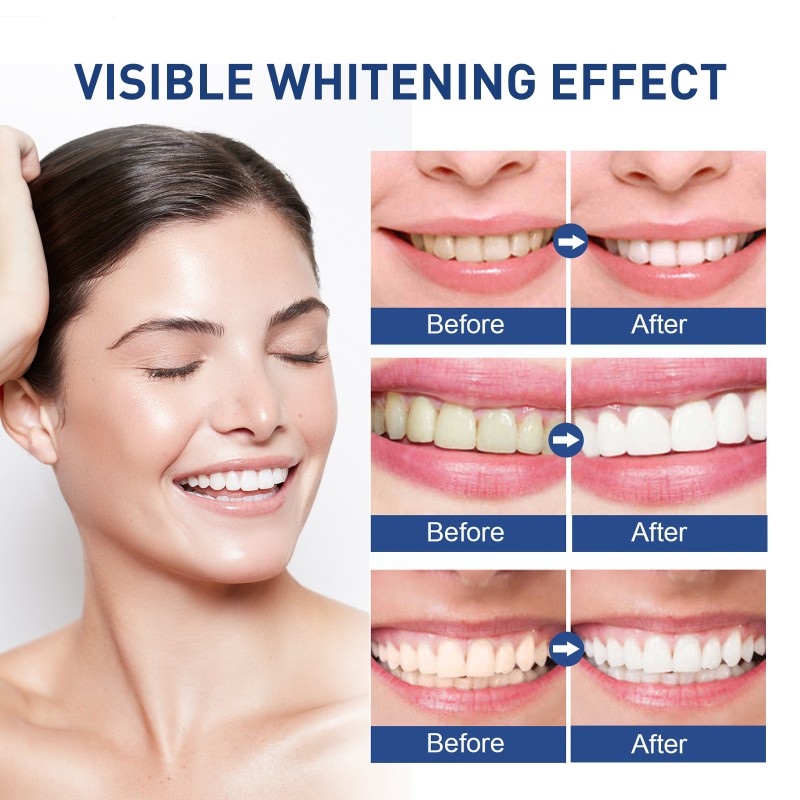 Tooth Paint Manufacturer - 5ml Multi-Purpose Instant Whitening