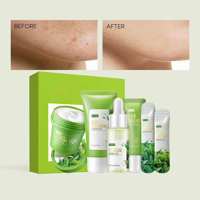 Skin Care Set Manufacturer - Green Tea Oil Control Repair