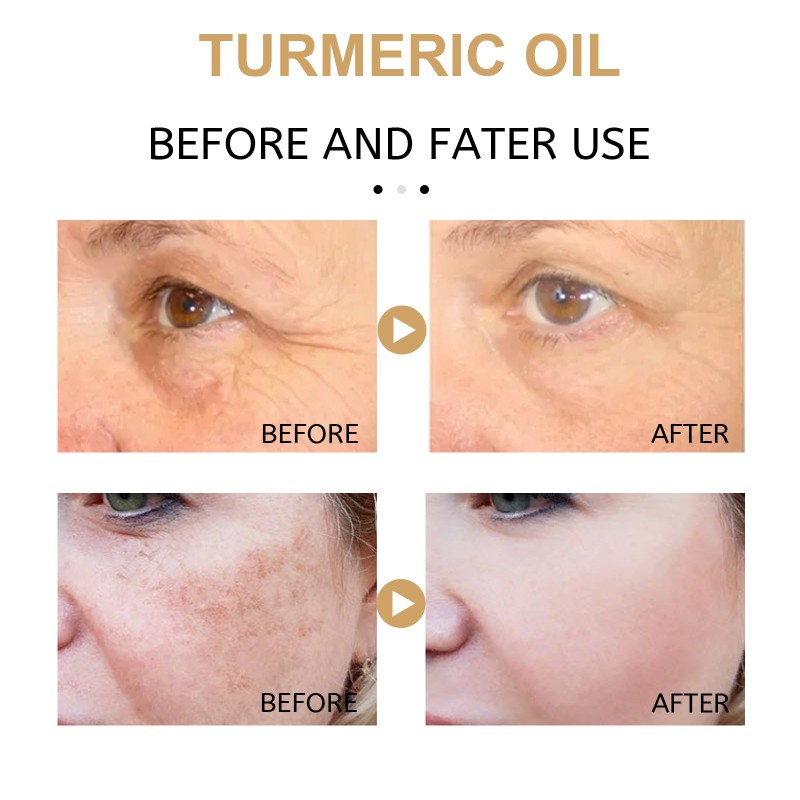 Face Oil Manufacturer - Vitamin C Turmeric Anti Aging 30ml