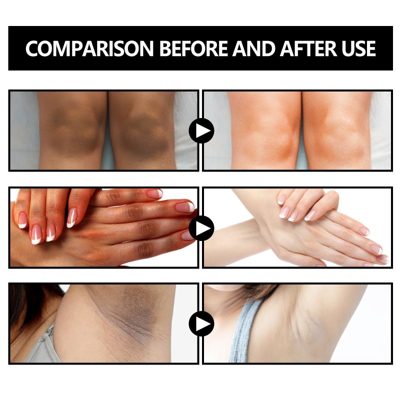 Whitening Soap Supplier - Bamboo Charcoal Armpit Bleaching 100g