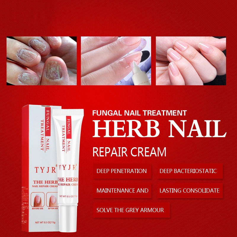 Nail Fungus Cream Manufacturer - Natural Herb Hand Foot Repair