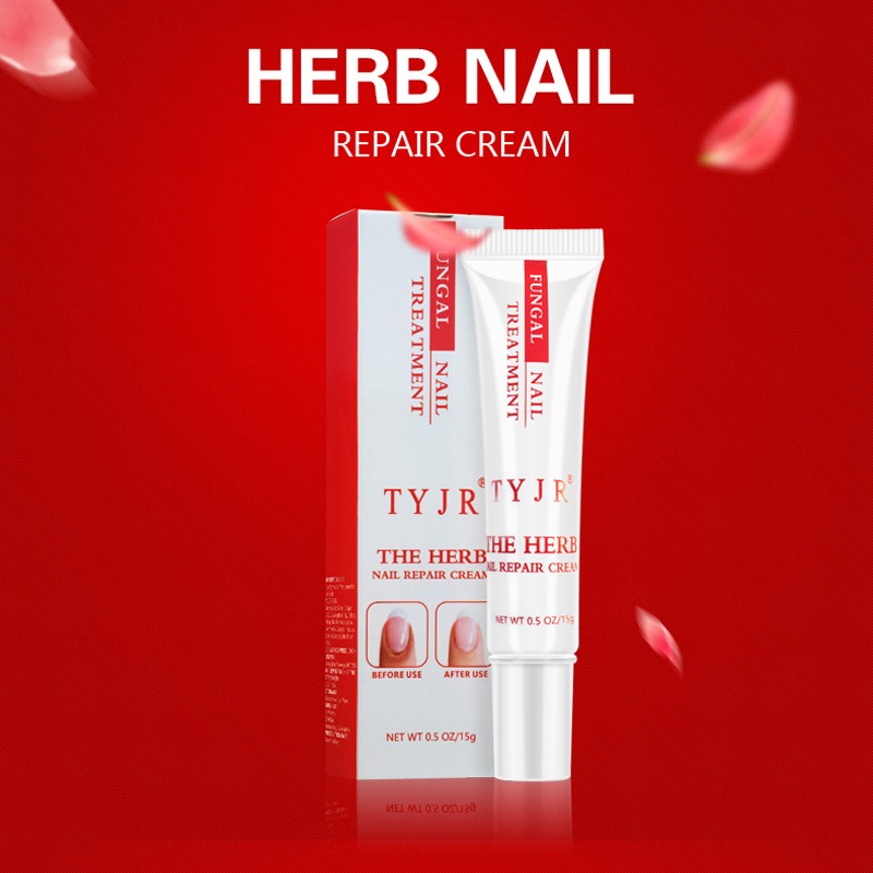 Nail Fungus Cream Manufacturer - Natural Herb Hand Foot Repair