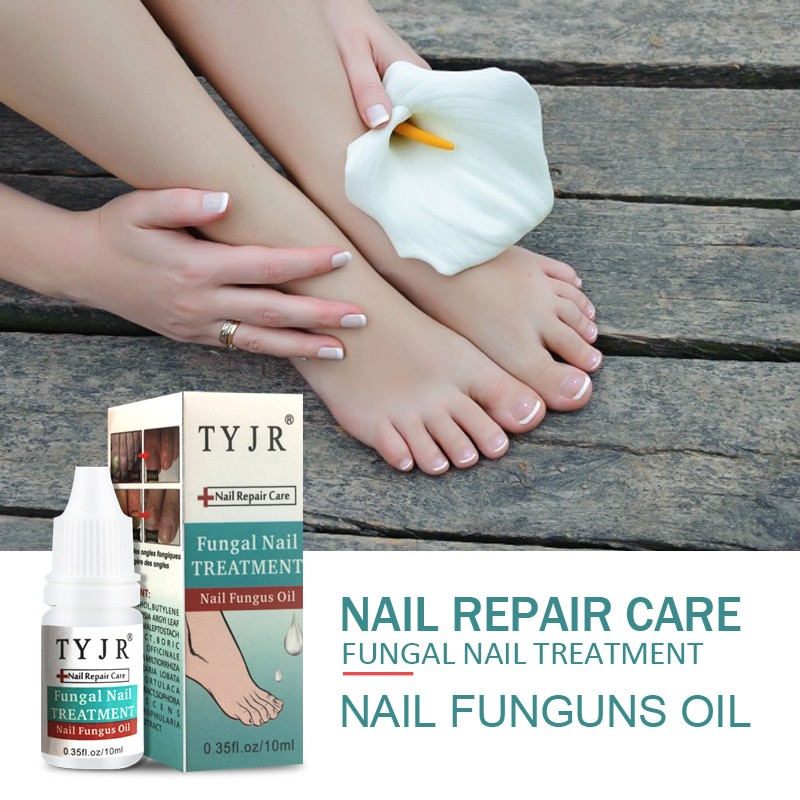 Nail Care Oil Supplier - Onychomucosis Paronychia Treatment