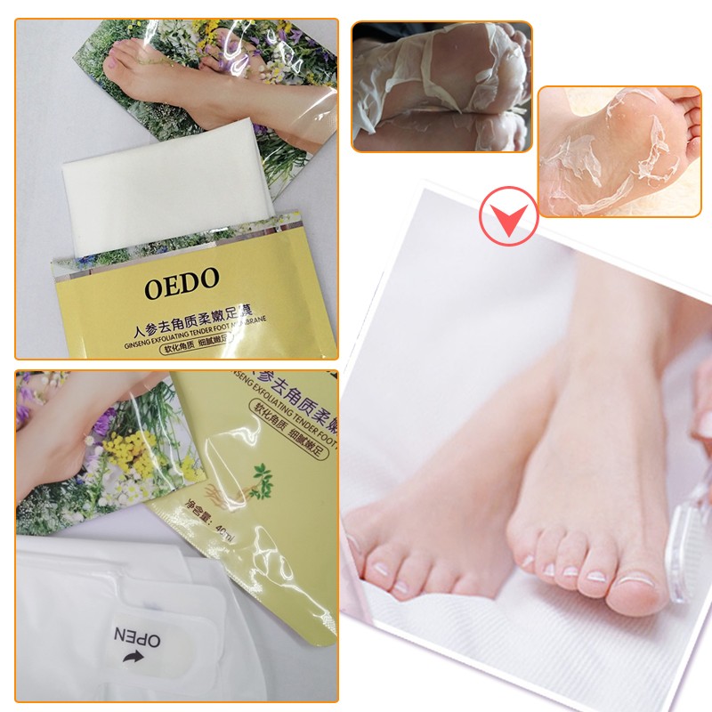 Foot Sheet Mask Manufacturer - Ginseng Dead Skin Removal
