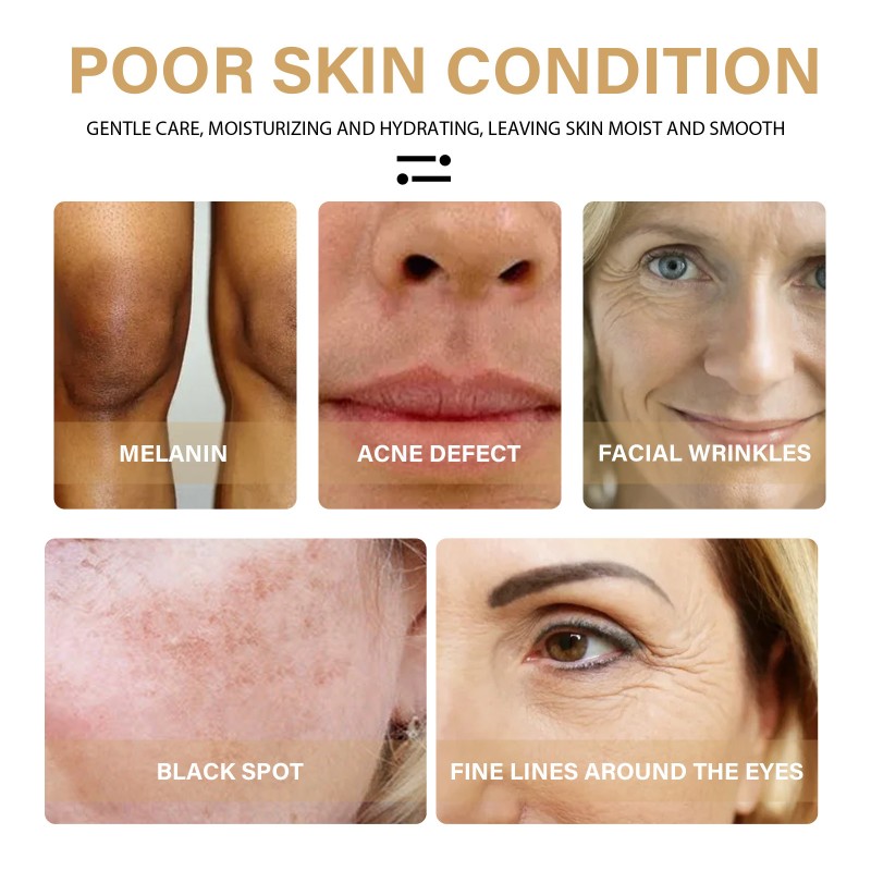 Face Oil Manufacturer - Vitamin C Turmeric Anti Aging 30ml